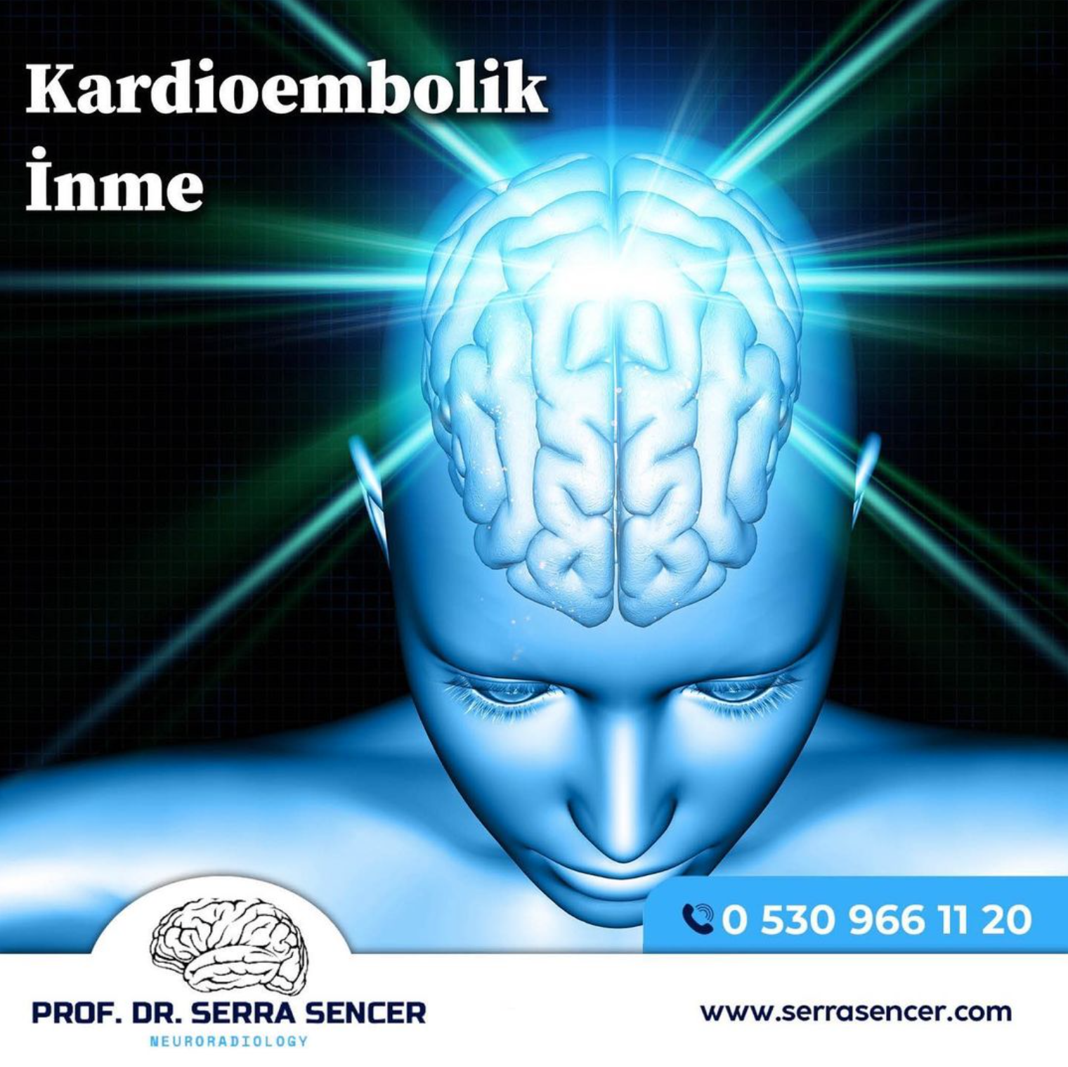 Kardioembolik İnme